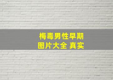 梅毒男性早期图片大全 真实